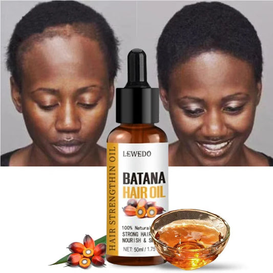 Revitalize Your Hair with 100% Pure Batana Oil - Fast Hair Growth Solution for Men and Women!